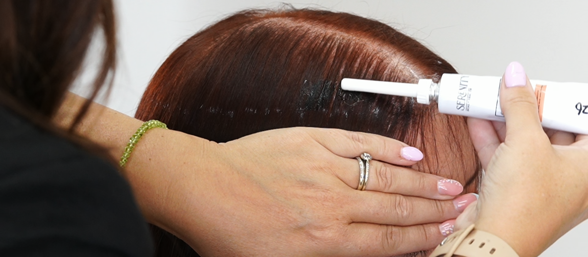 Serenity adhesive applied during a Skalp360 fitting